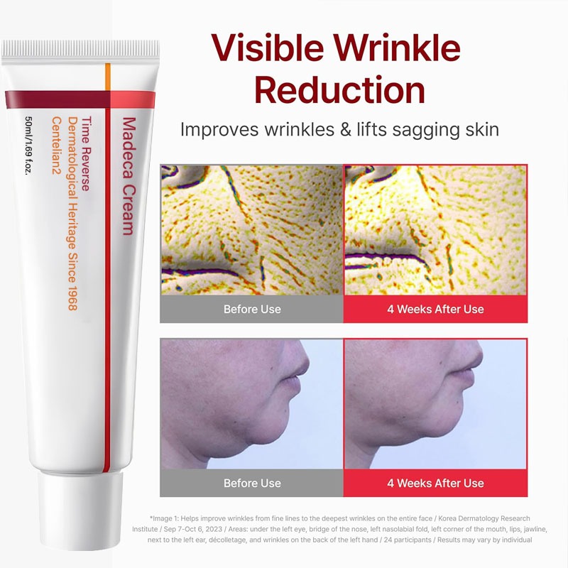 Korean Skin Care Madeca Cream  - đánh giá và giá Skincare Whitening