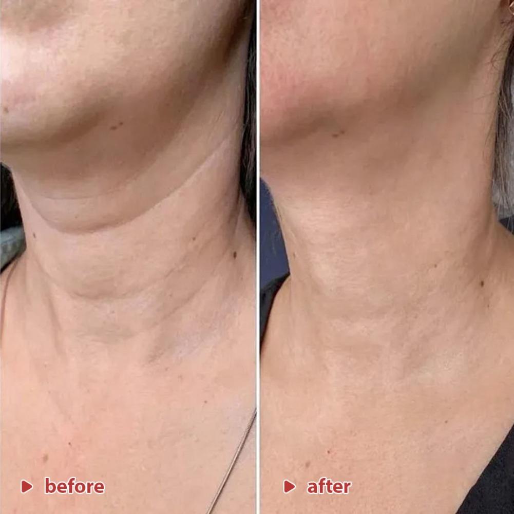 50ml Korean Koriderm Time Reve - đánh giá và giá Peptide Neck Cream